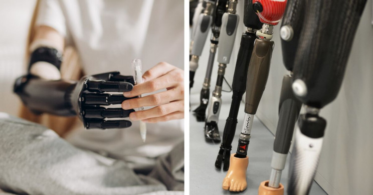 Essential things to know before getting a prosthetic leg