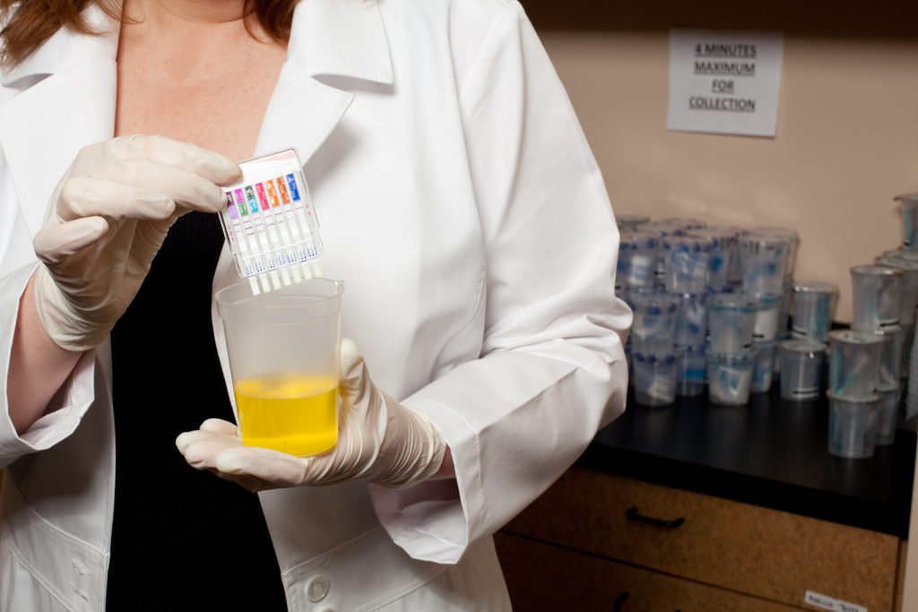 The Art of Substitution- Navigating Drug Tests with Synthetic Urine
