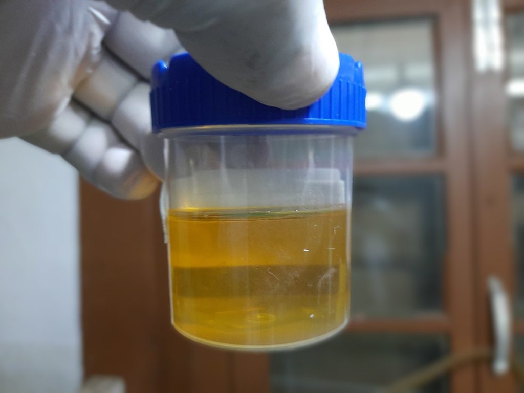 Legal Implications of Using Synthetic Urine to Pass a Urine Drug Test